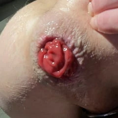 Prolapse pumping 