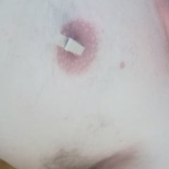 Nipples