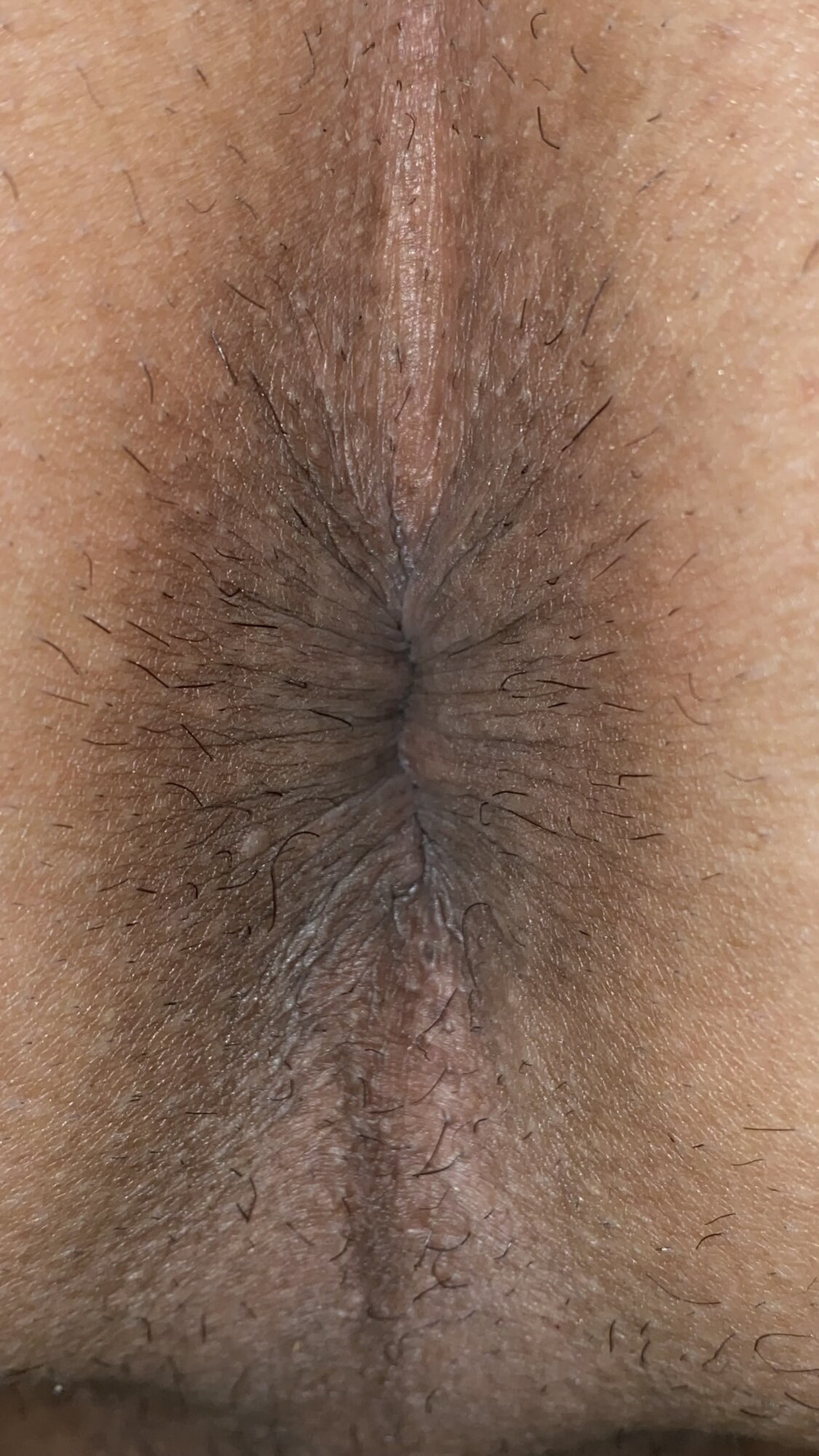 Close-up of a man&#039;s anus #28