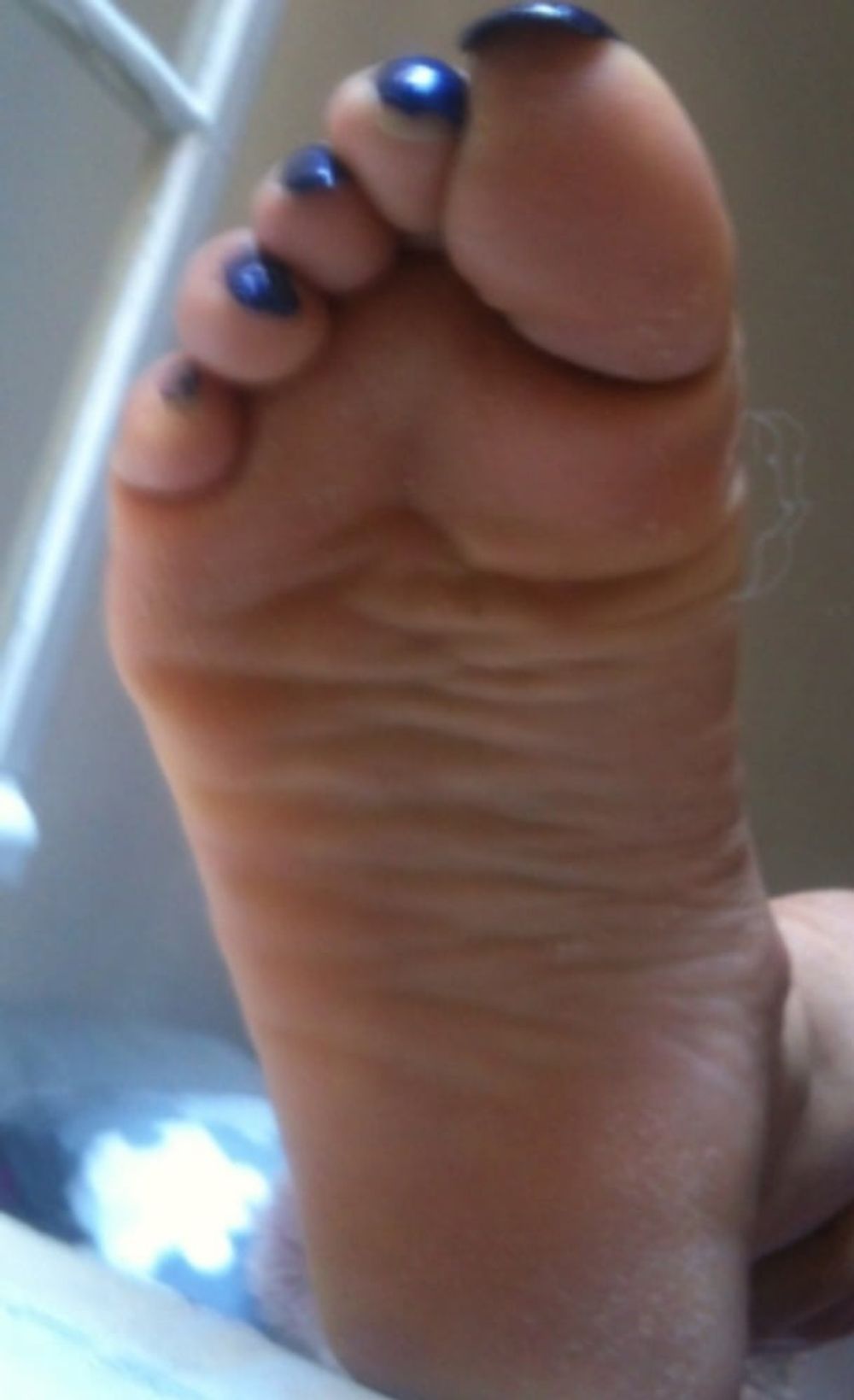 blue toenails and soles feet after day at beach  #22