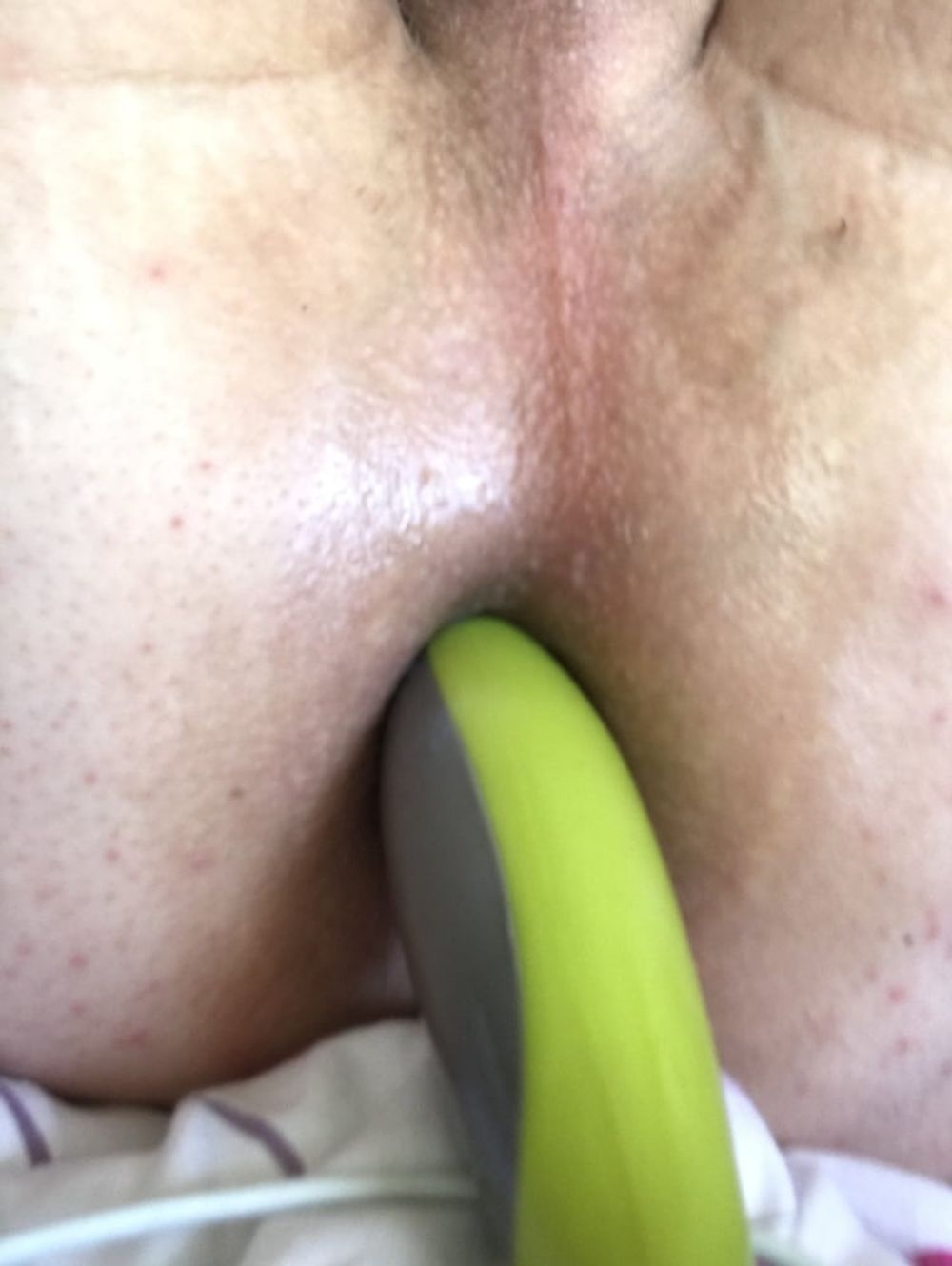 Anal #2