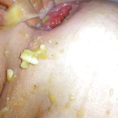 Banana in my gaping asshole close up