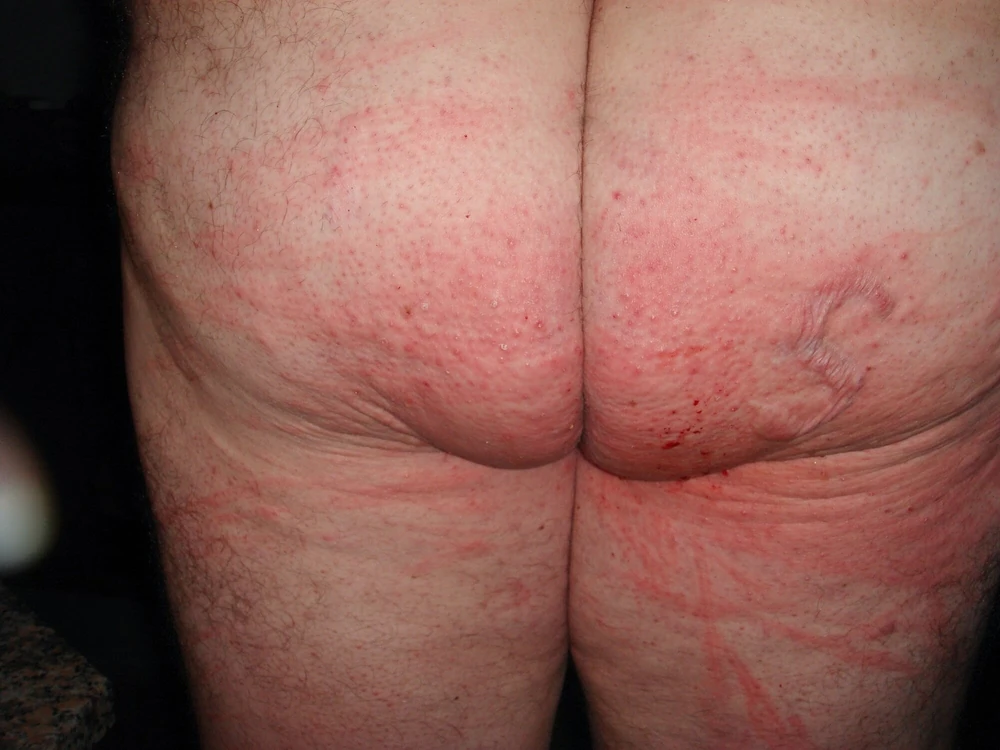 Micro penis #25