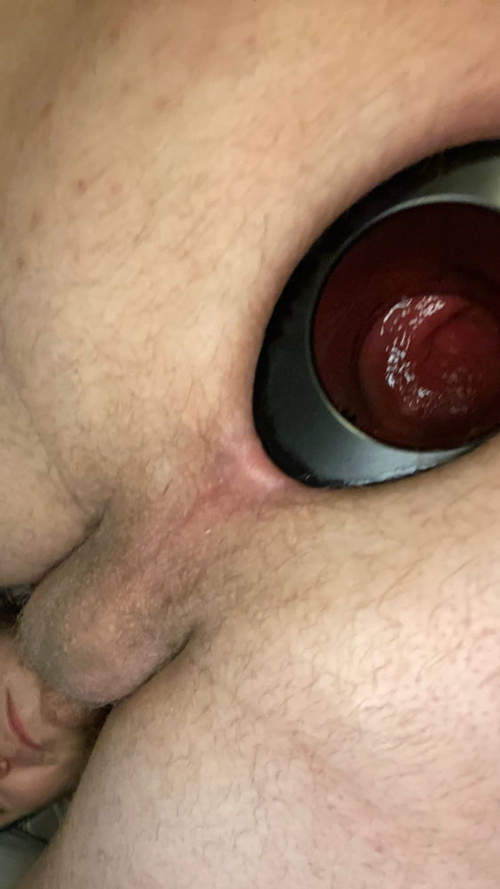 XXL MEO 24/7 Anal Stretching Ring #13