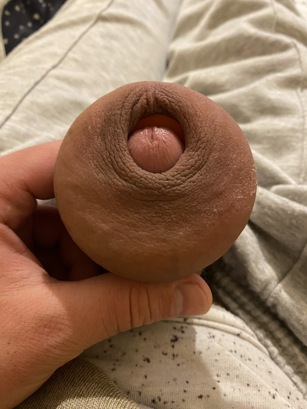 extreme stretching foreskin