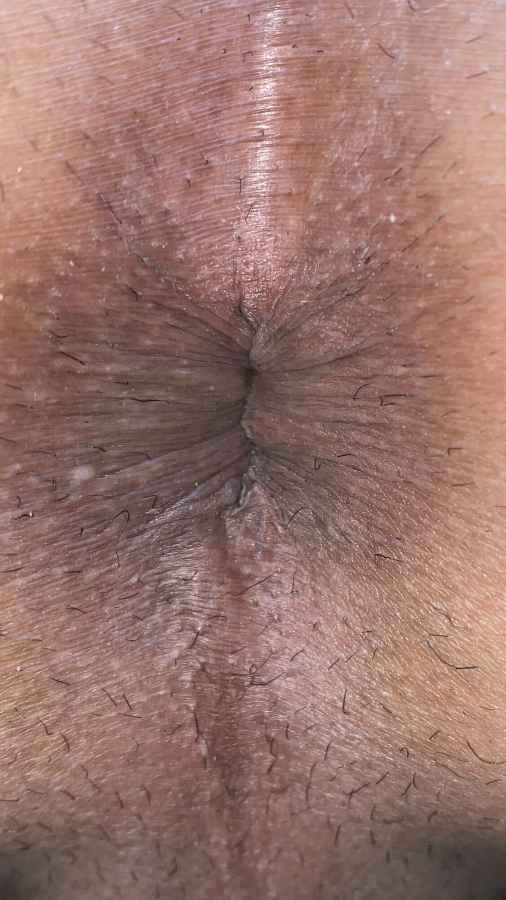 Close-up of a man&#039;s anus #12