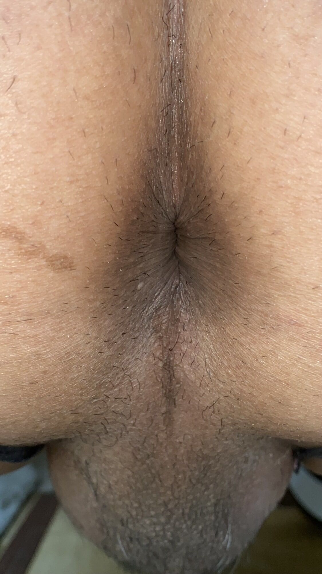 An image of my anus that is clear to every single wrinkle #36