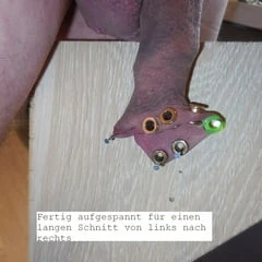 20230311_Foreskin cutting