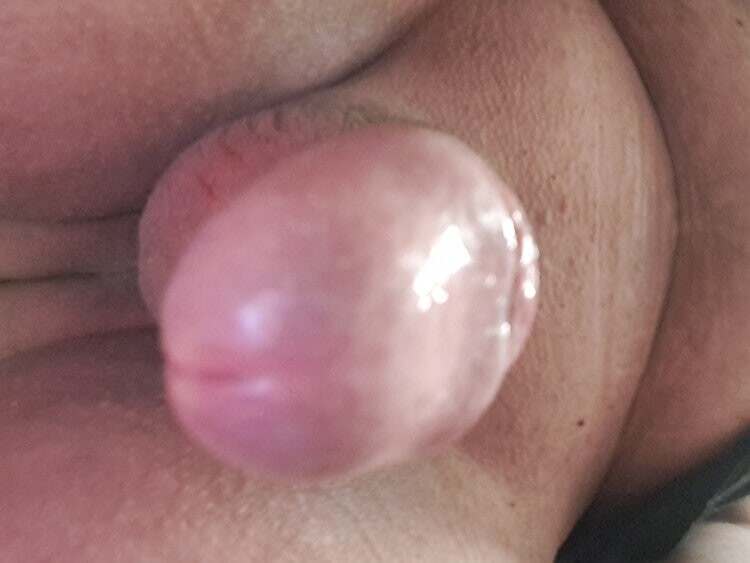 Moi  #4
