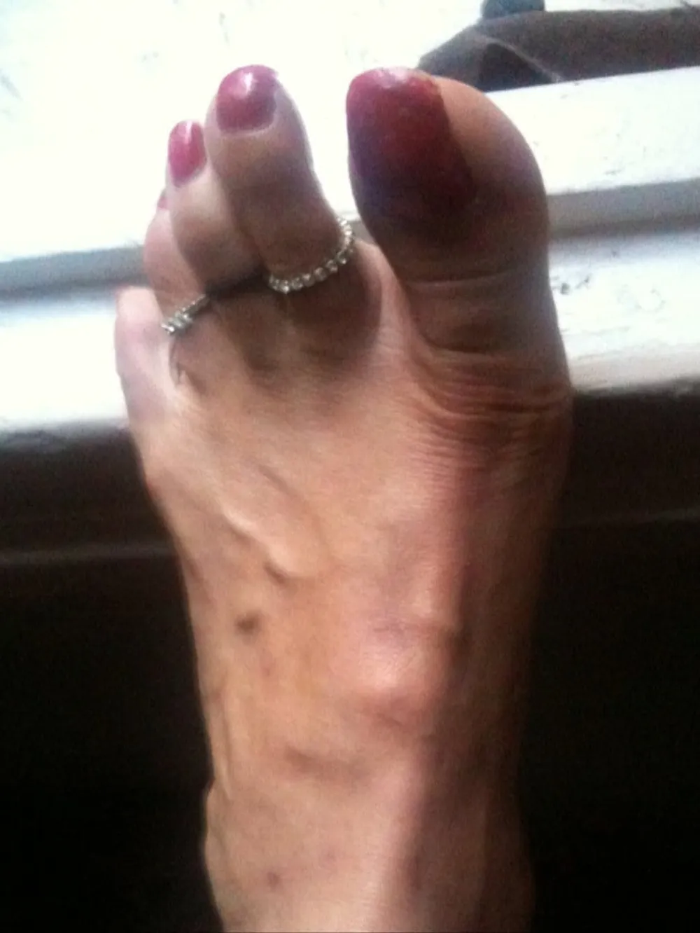 red toenails mix (older, dirty, toe ring, sandals mixed). #36