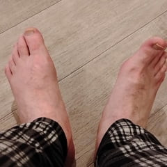 My Feet After a Long Day