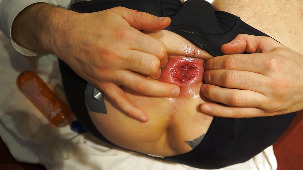 My asshole spread fist prolapse and gape Dez 2012 #17