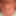 Micro penis, pre-cum photos