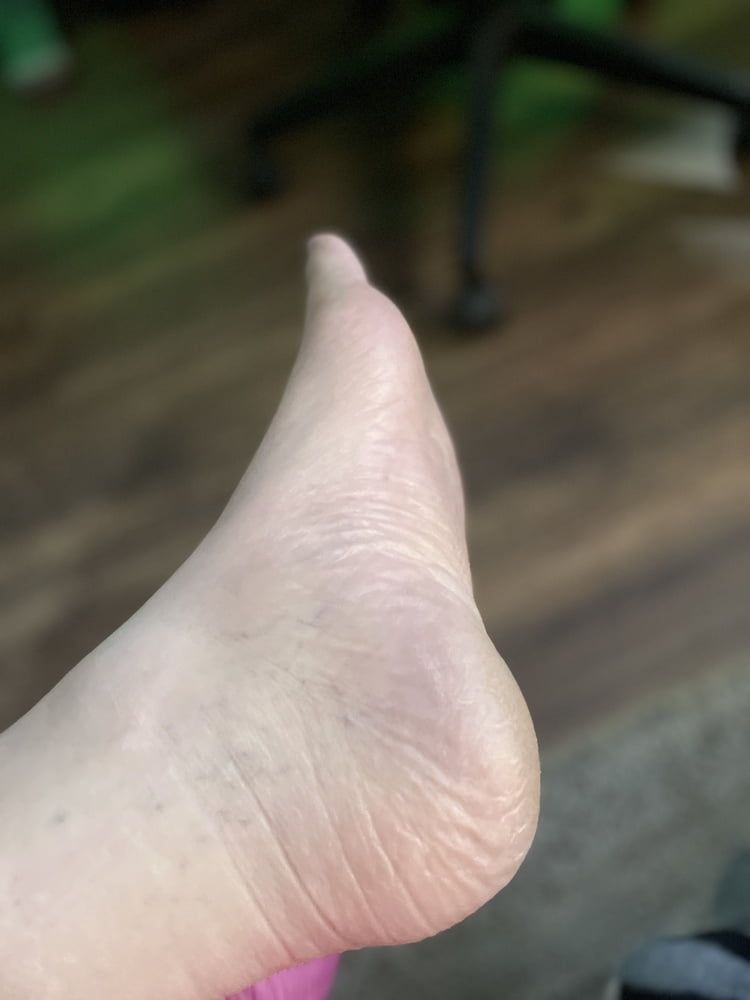 foot fetish pics