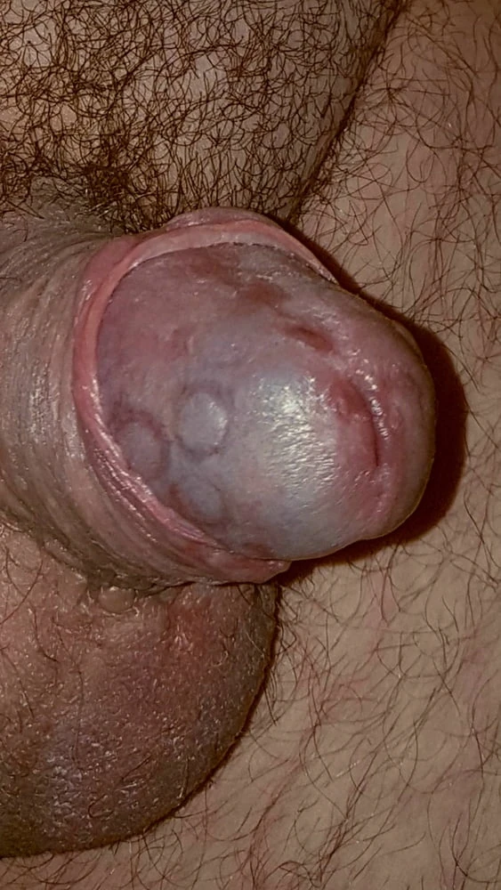 MY ACORN FOR YOU #2