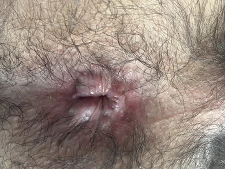 hairy hole