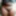 Pussy growing hair gallery 