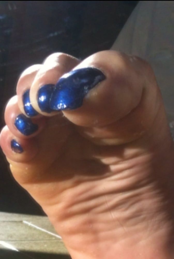 Blue toenails under sun ray #2