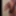 202310_acutal condition #4