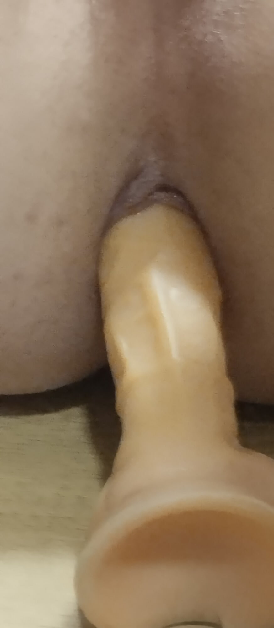 Anal #6