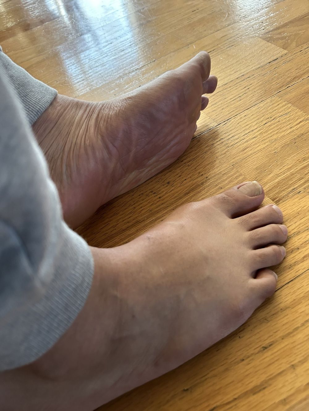 Feet