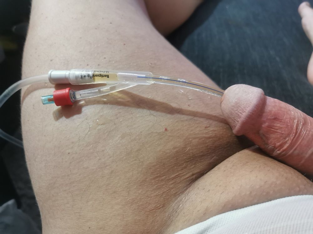 Catheter #4