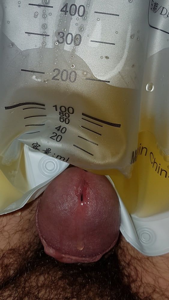Catheter sounding with my urine 2 #9