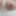 My nipples
