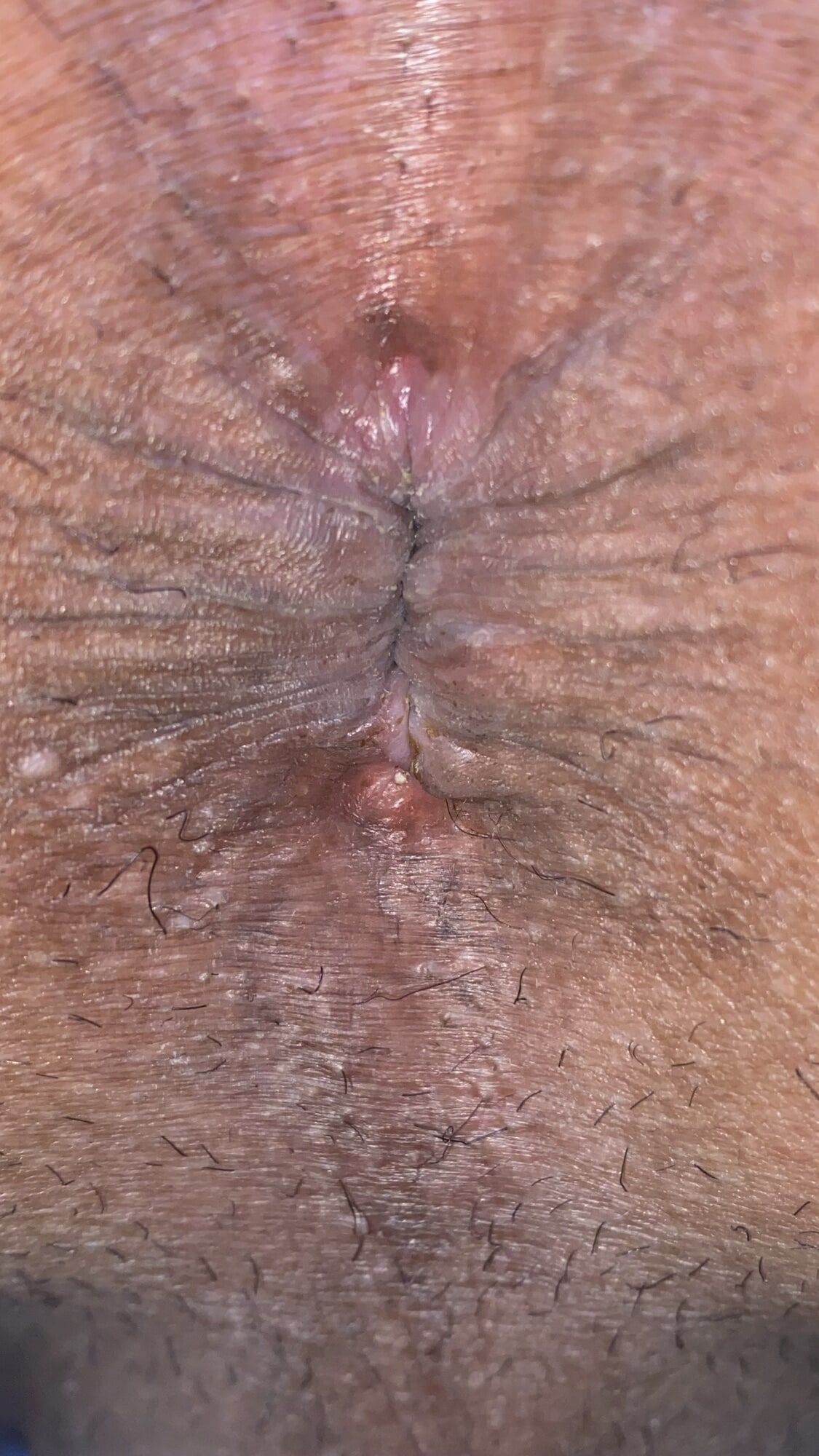 Close-up of a man's anus #16