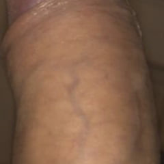 Mi polla