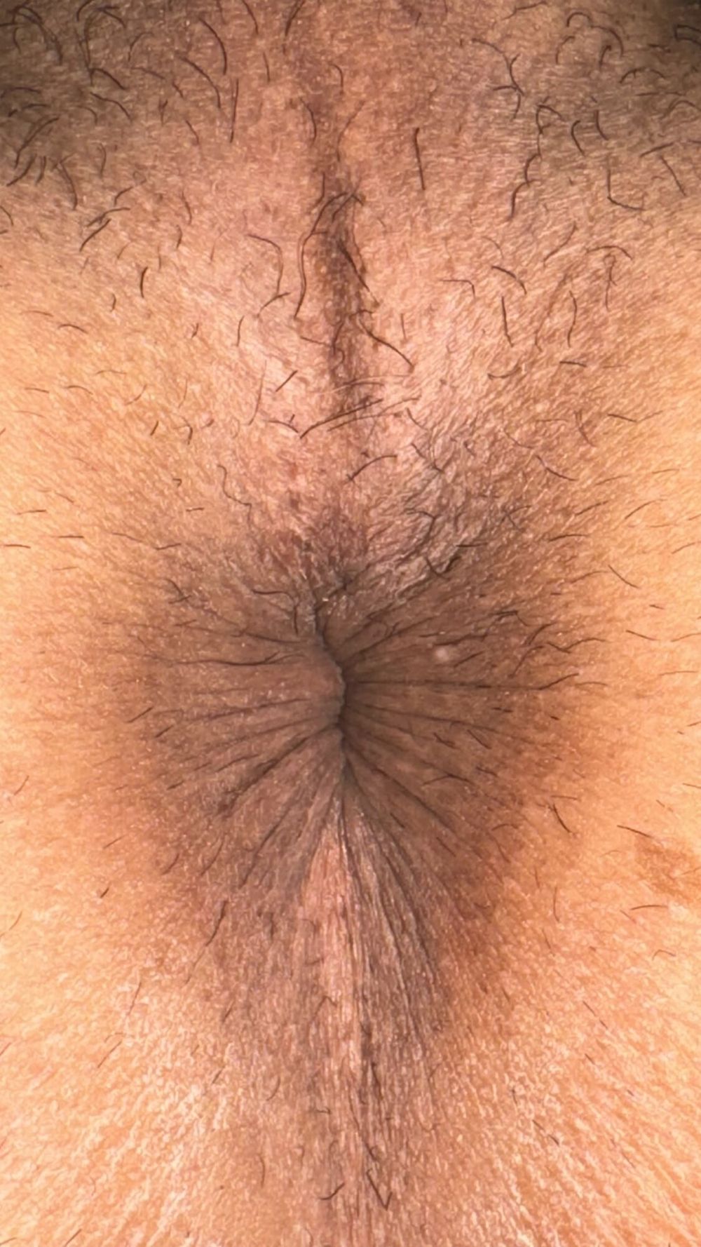 my anus #34