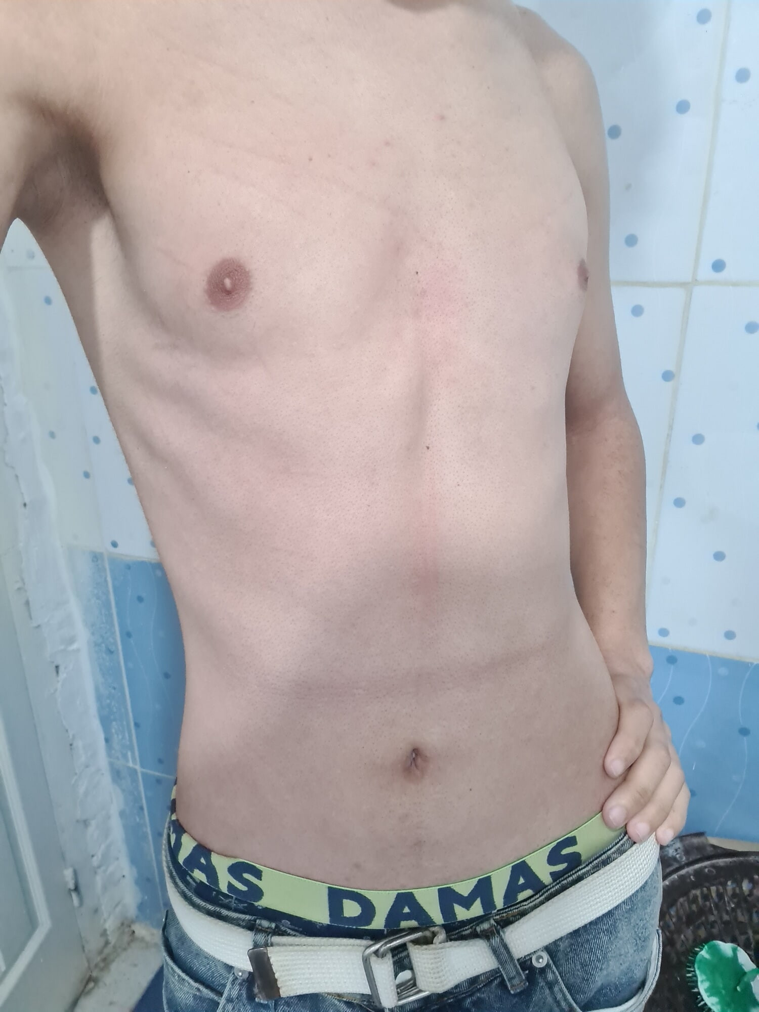 ร่างกายในระยะใกล้ 