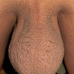 My balls...