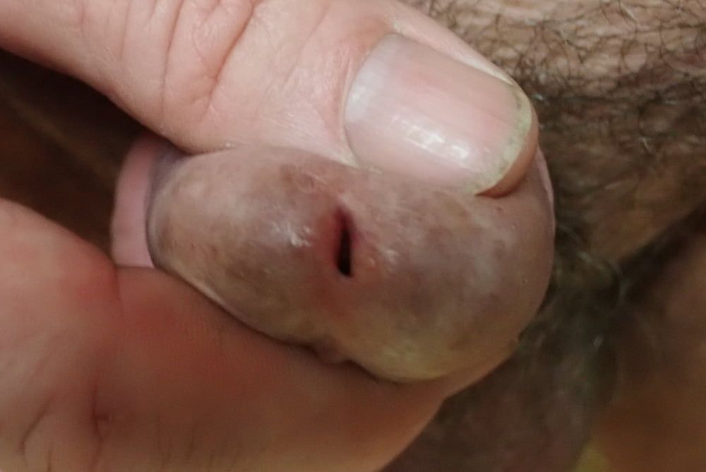 my penis up close #12