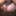 WHOOPS - 45y MILF Creampie After Condom Broke #35