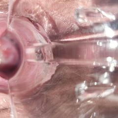Speculum 