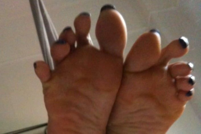 blue toenails and soles feet after day at beach  #51