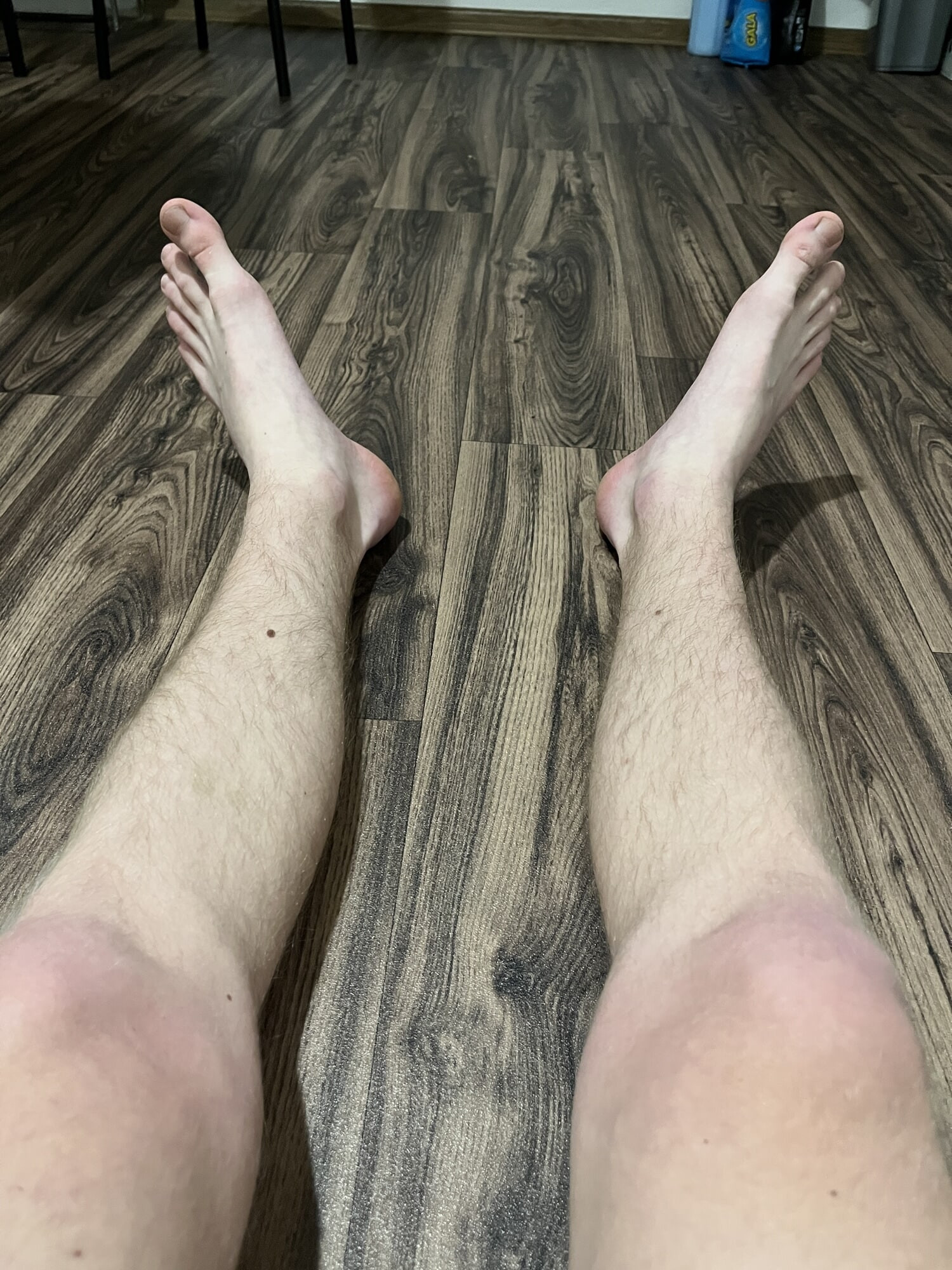 My feet #30