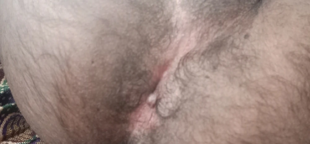 hairy ass  #5