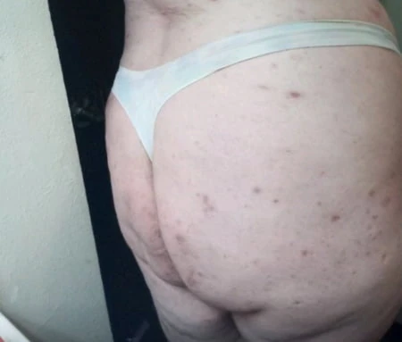 Whitechub