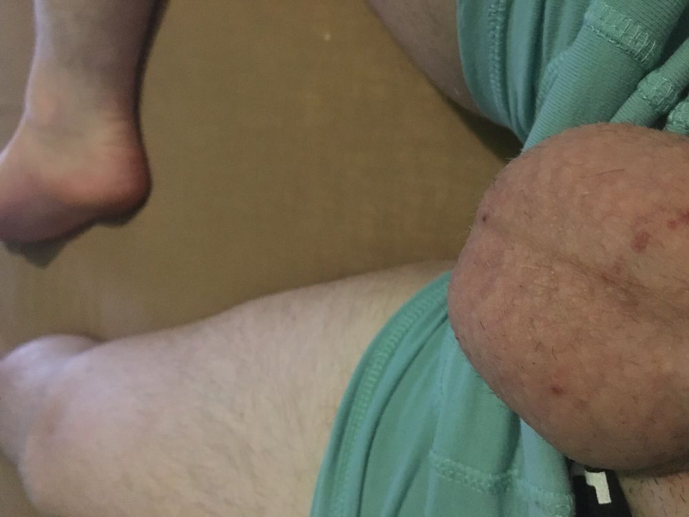 Foreskin Play With Cum Filled Balls  #41