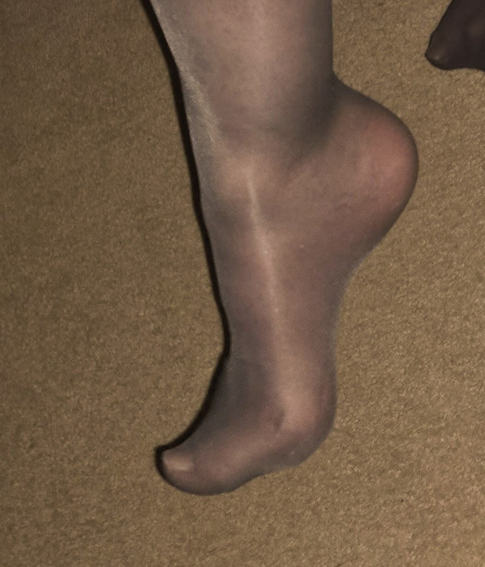 Louise Nylontease  #9