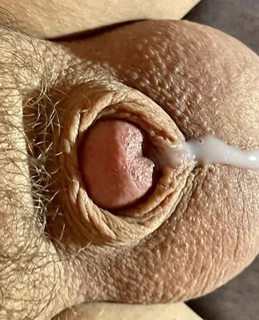 tiny penis micro cock inverted cock photos         