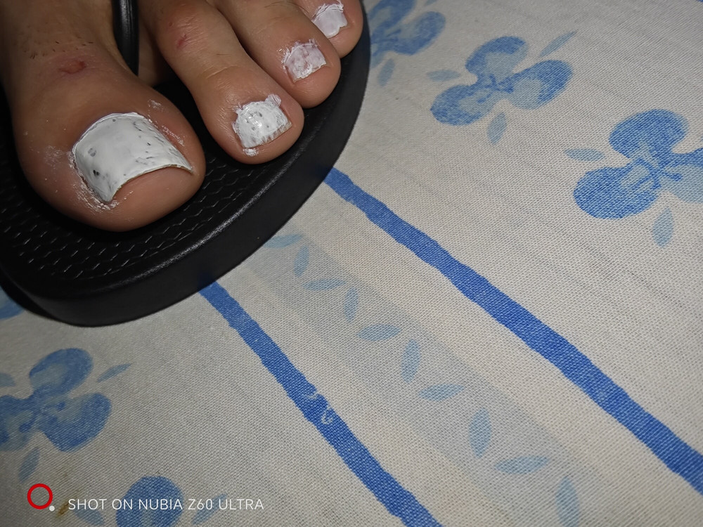 Feet CsG 1.1 #17
