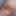 Close up foreskin and glans #2
