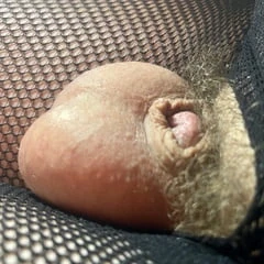 Micropenis