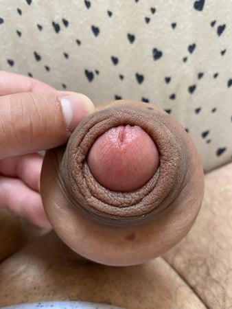 Foreskin extreme bondage