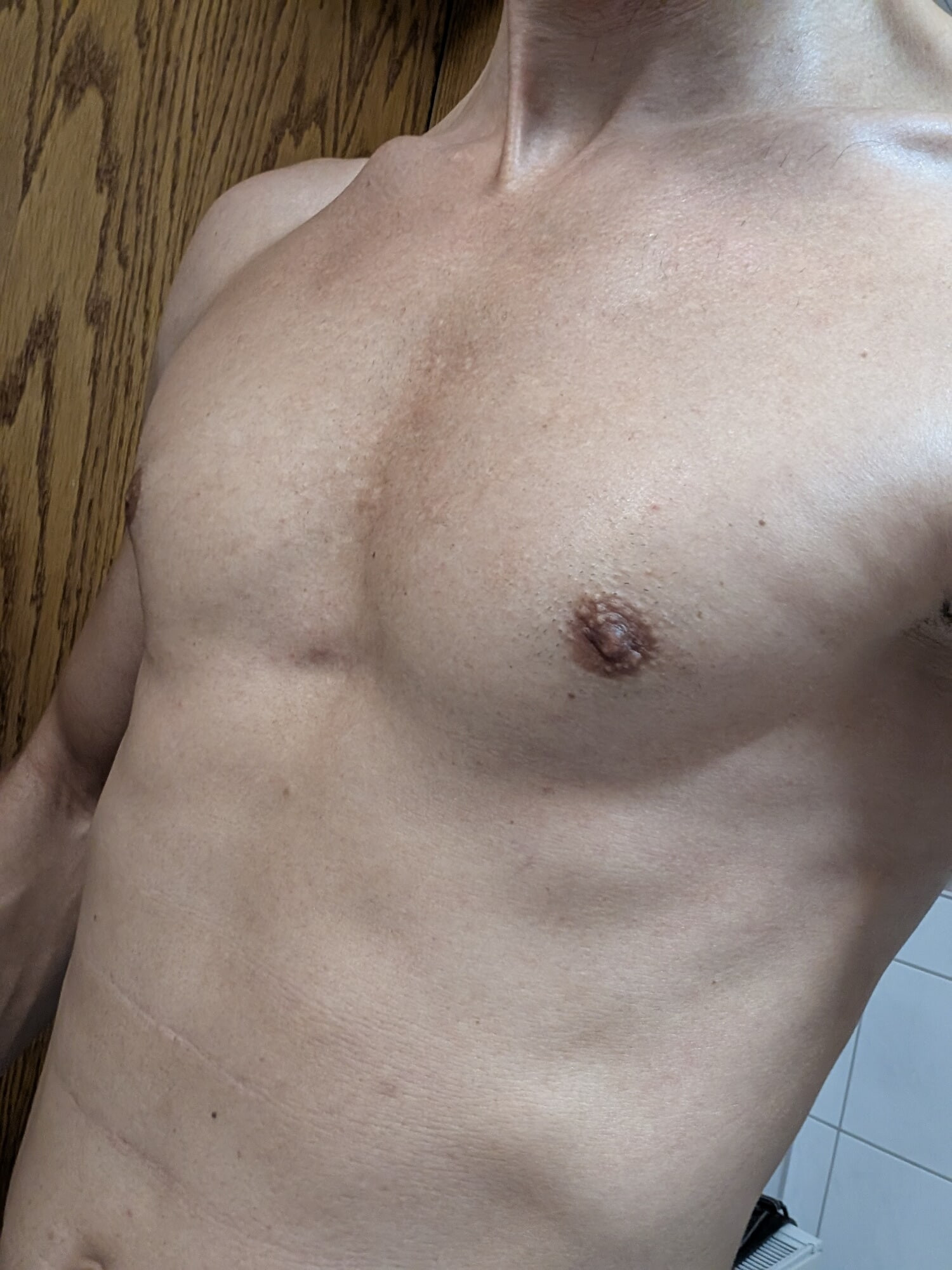 Body