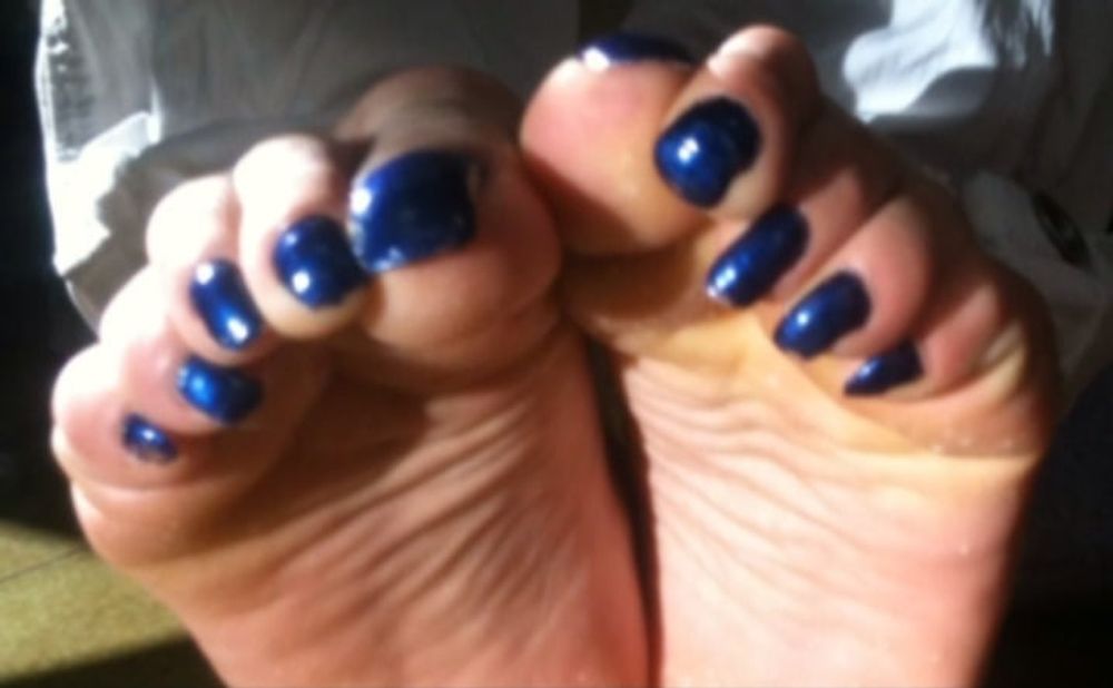 Blue toenails under sun ray #32