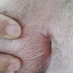 Sommer hot
